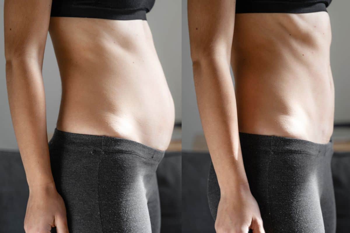 Post-Pregnancy: What Happens to Your Abdominal Muscles After Birth Greater London (Lambeth)