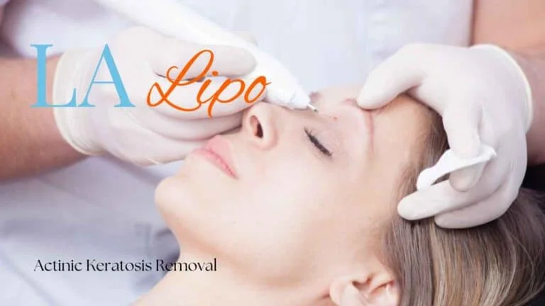 Woman receiving Actinic Keratosis Removal Treatment Greater London (Lambeth)