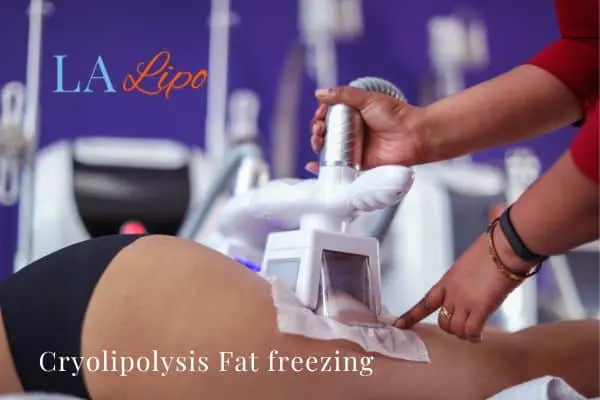 women getting fat freezing Greater London (Lambeth)