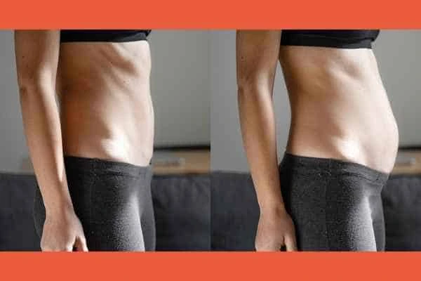 LA-EMS Body Sculpting results Greater London (Lambeth)