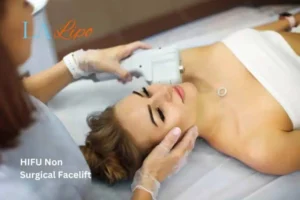 Woman having Hi-Fu to reduce wrinkles Greater London (Lambeth).