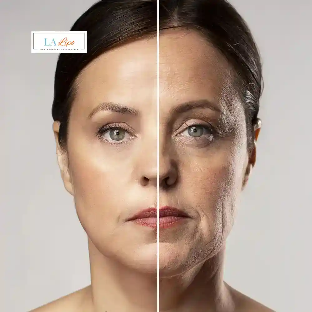 How Can You Tell If Non-Surgical Skin Tightening Is Right for You Greater London (Lambeth)?
