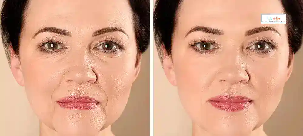 Why Aren’t My Skincare Products Making My Sagging Skin Look Firmer Greater London (Lambeth)?