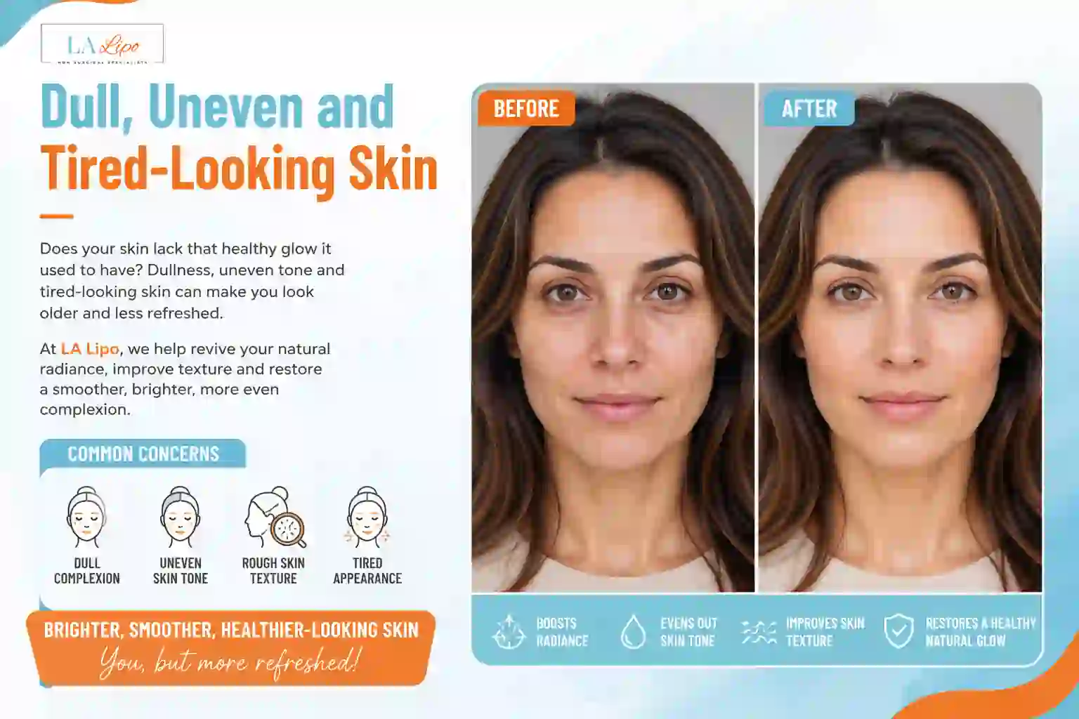 Sign #5: Dull, Uneven and Tired-Looking Skin Greater London (Lambeth)