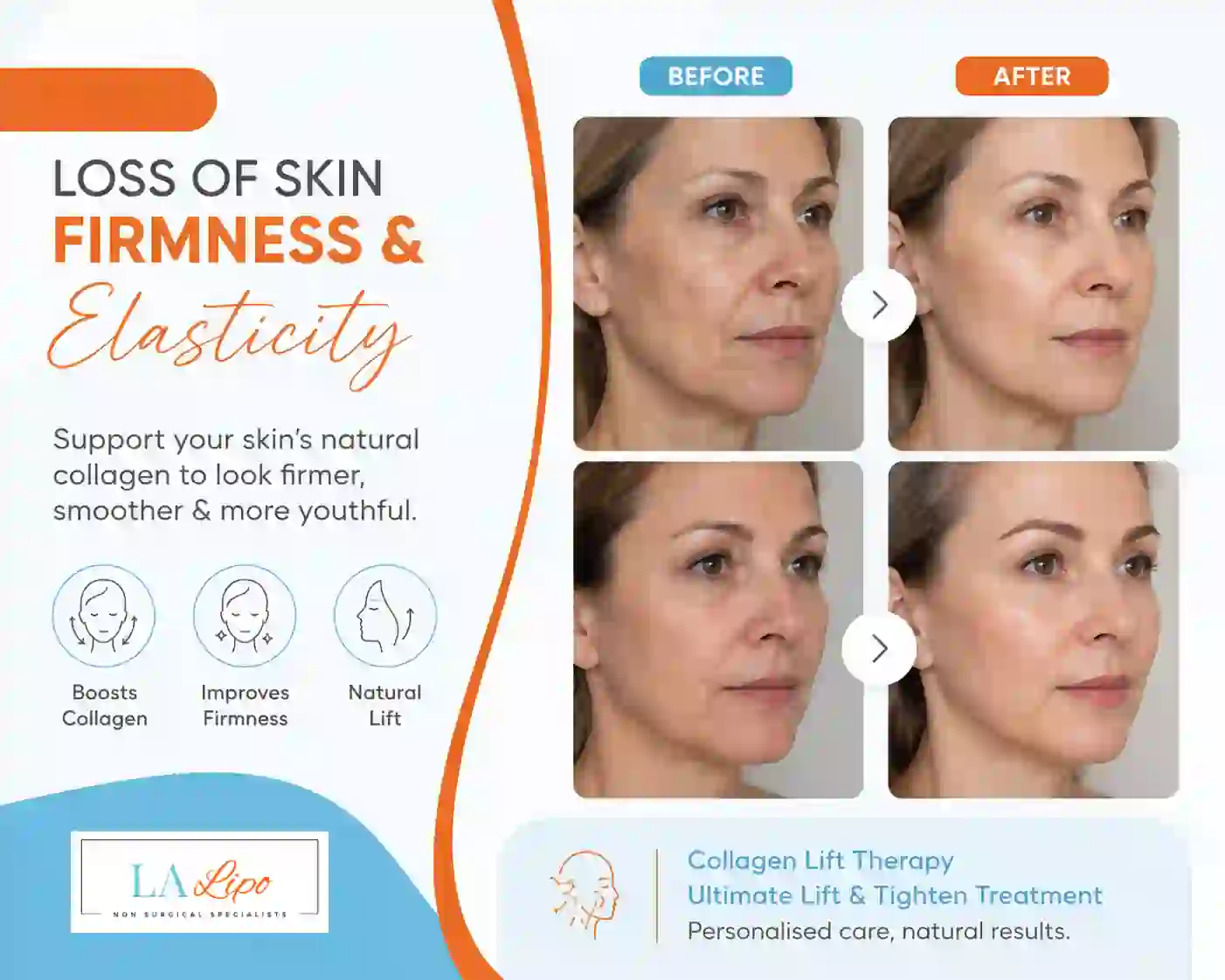 Sign #7: Loss of Skin Firmness and Elasticity Greater London (Lambeth)
